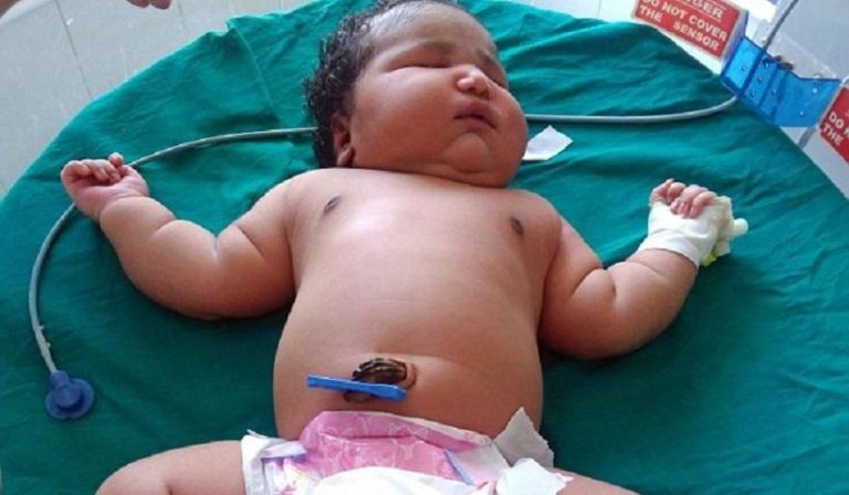 Μωρό-γίγας στην Ινδία γεννήθηκε επτά κιλά
