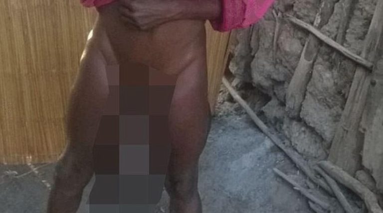 Δεν μπορεί να κάνει σεξ λόγω μεγέθους!