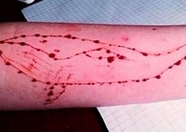 Μαρτυρία 14χρονου από το Κιλκίς για τη “Μπλε Φάλαινα”