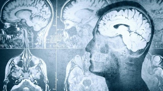 Τι συμβαίνει στον εγκέφαλο πριν το θάνατο
