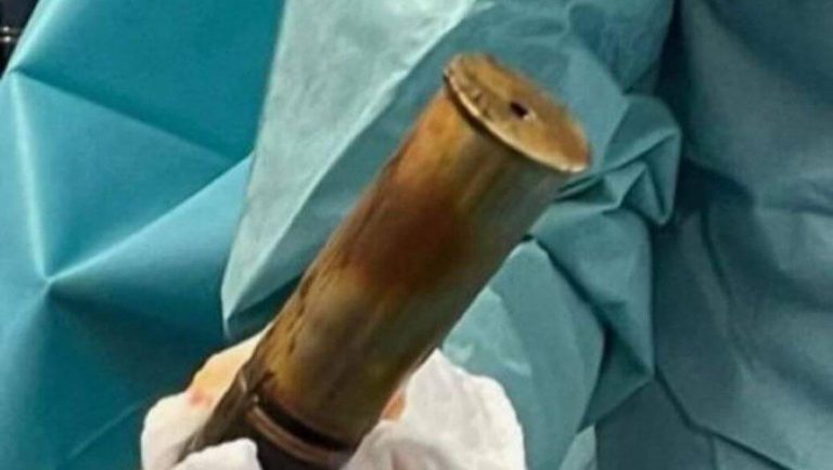 «Γιατρέ, έχω μία βόμβα στον κ… μου»